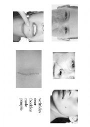 English Worksheet: Face Defects