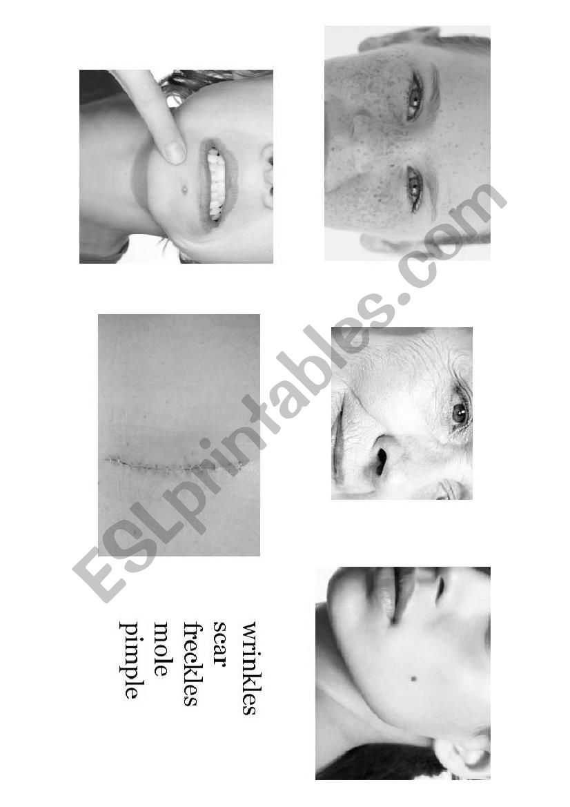 Face Defects worksheet